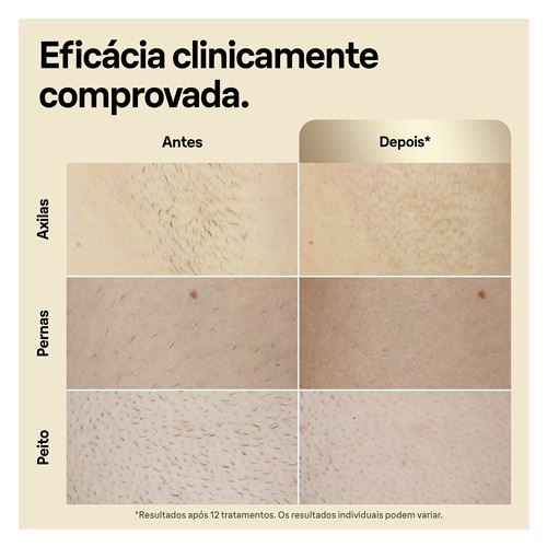 Depiladora Luz Pulsada IPL Braun Silk Expert S5 PL5140 Online now